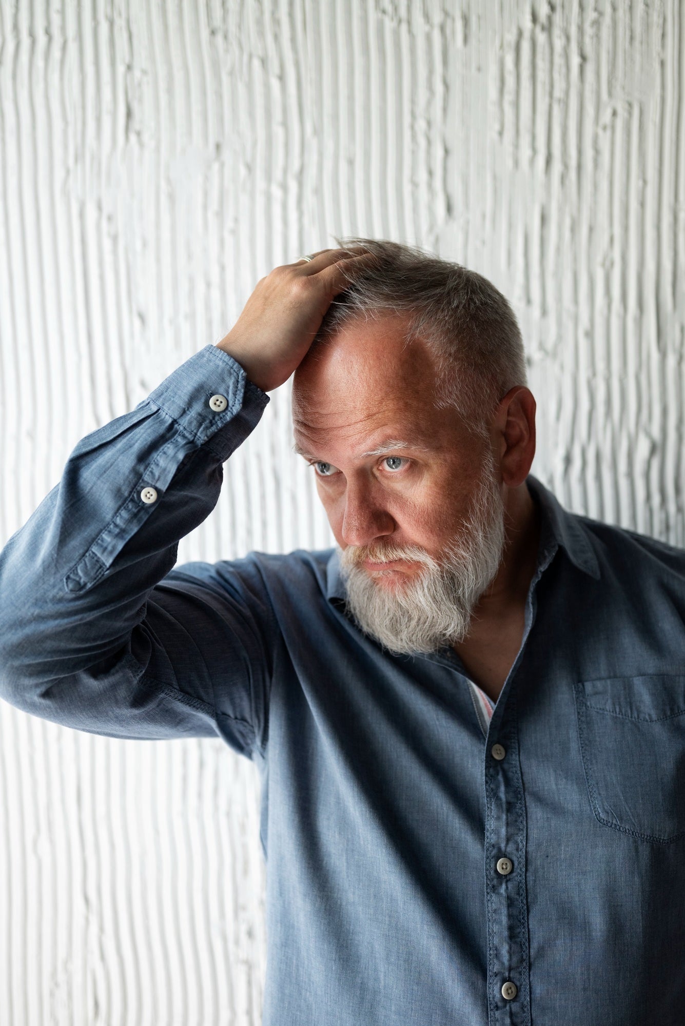 Hair Loss